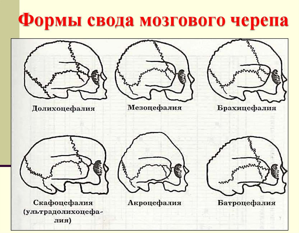 Формы свода мозгового черепа