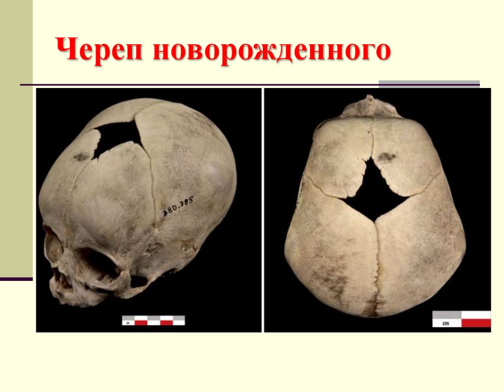 Череп новорожденного