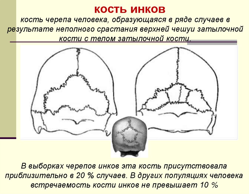 кость инков