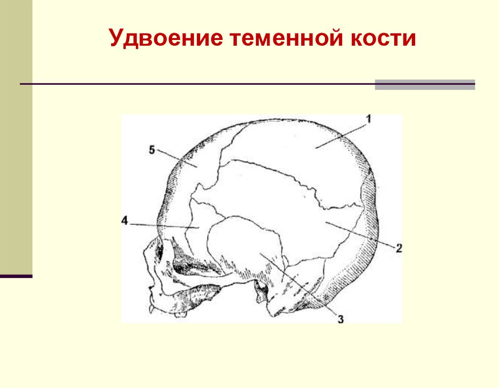 Удвоение теменной кости