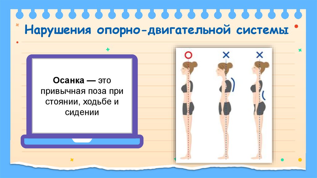 Нарушения опорно-двигательной системы