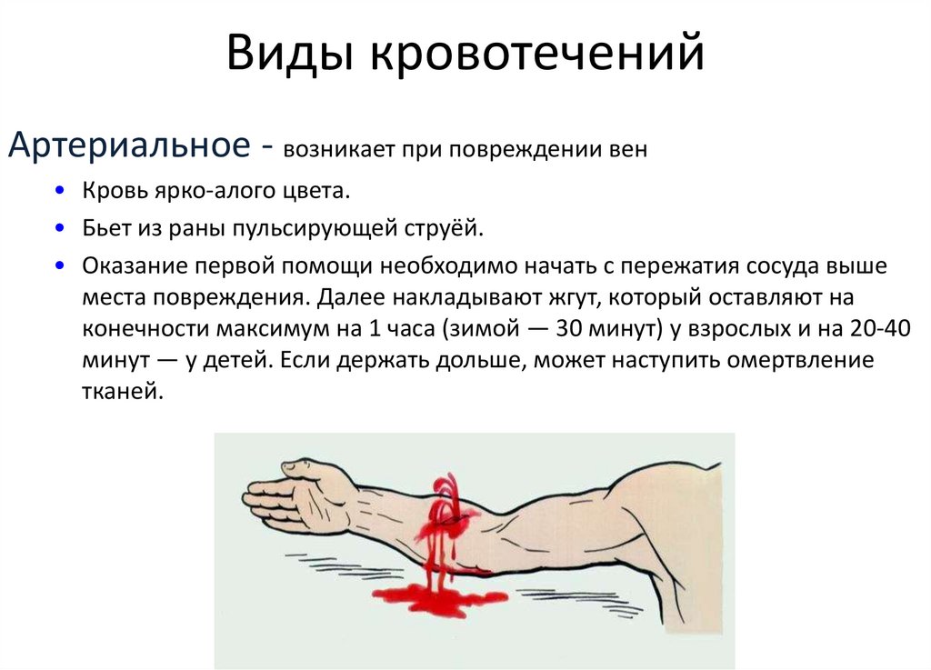 Виды кровотечений
