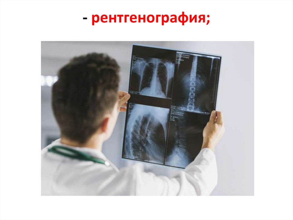 - рентгенография;