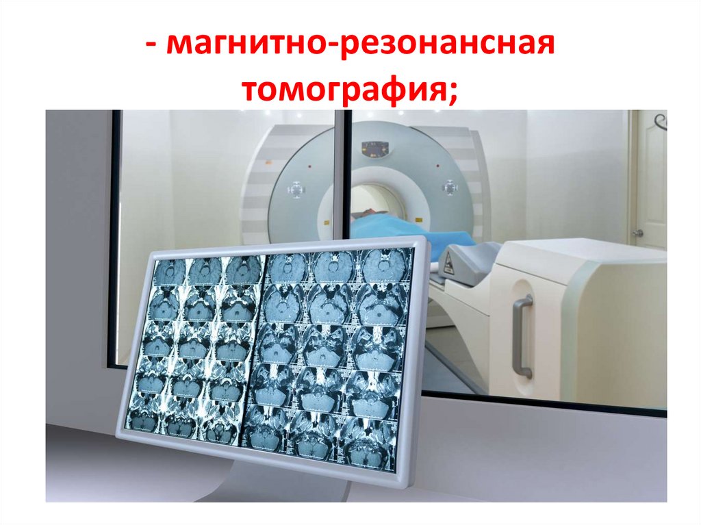 - магнитно-резонансная томография;