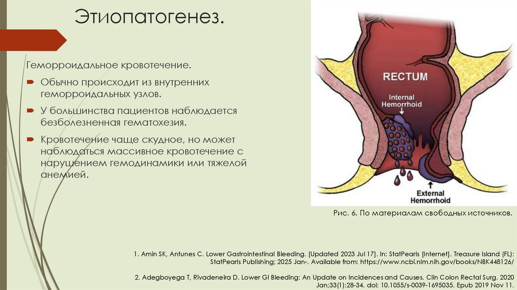 Этиопатогенез.