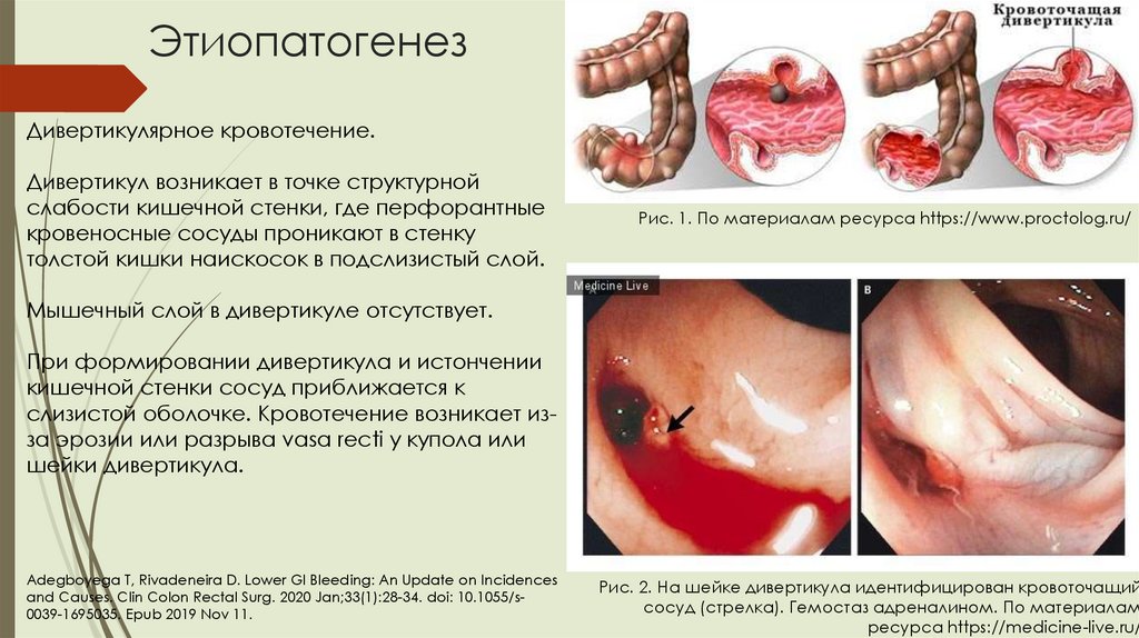 Этиопатогенез