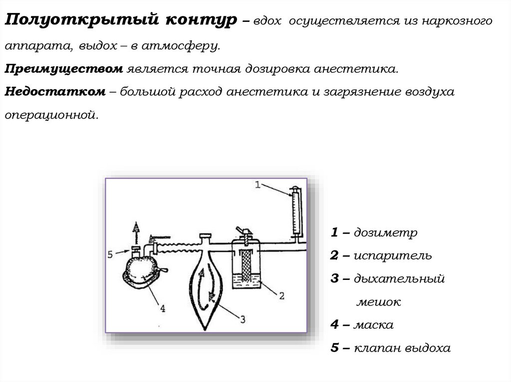 Полуоткрытый контур – вдох осуществляется из наркозного аппарата, выдох – в атмосферу. Преимуществом является точная дозировка