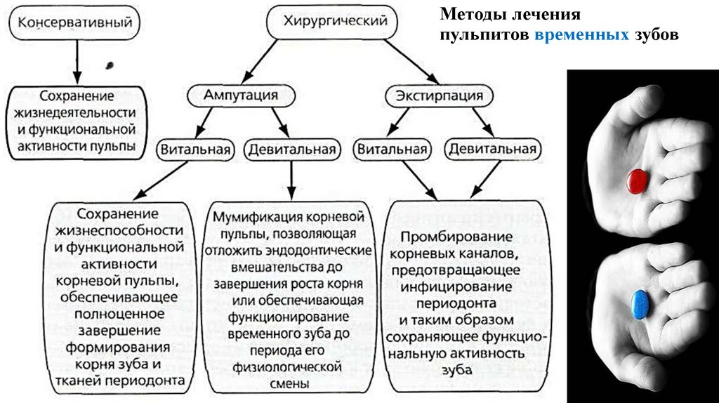 Методы лечения пульпитов временных зубов