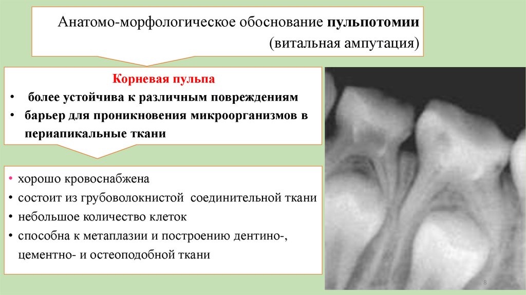 Анатомо-морфологическое обоснование пульпотомии (витальная ампутация)