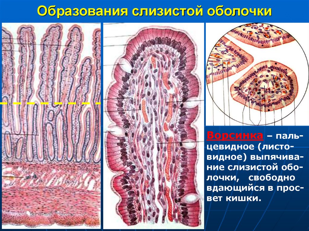 Образования слизистой оболочки