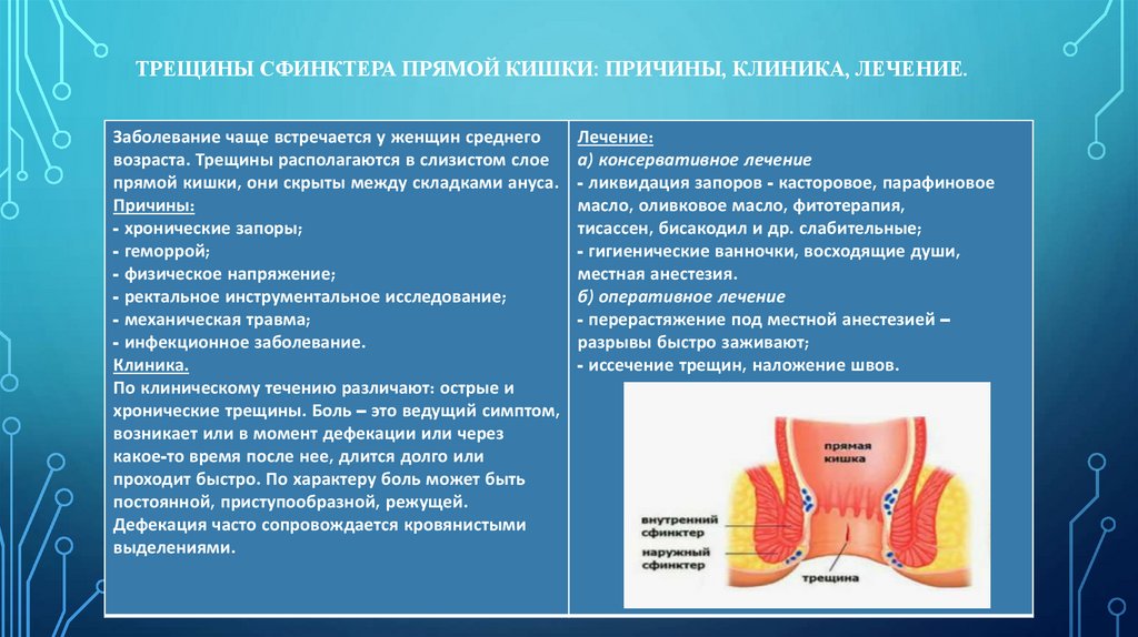 Трещины сфинктера прямой кишки: причины, клиника, лечение.