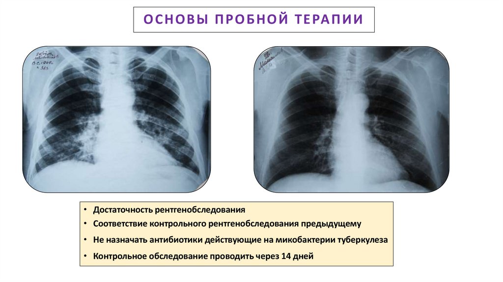 ОСНОВЫ ПРОБНОЙ ТЕРАПИИ