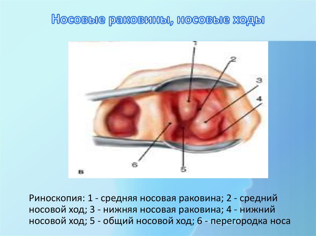 Носовые раковины, носовые ходы