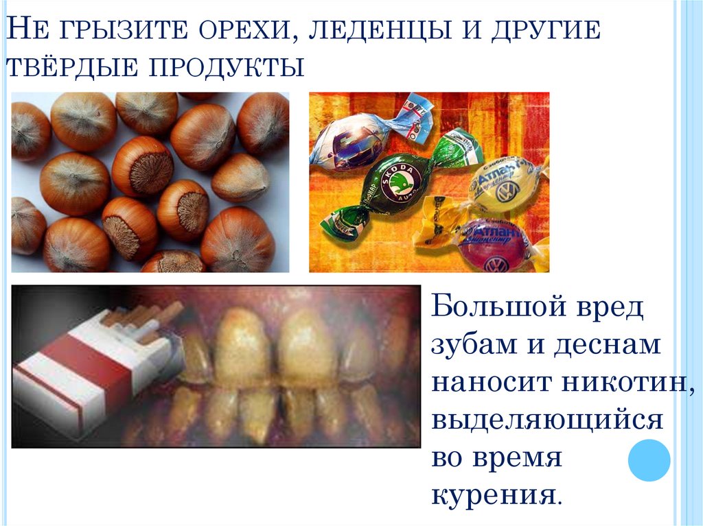 Не грызите орехи, леденцы и другие твёрдые продукты