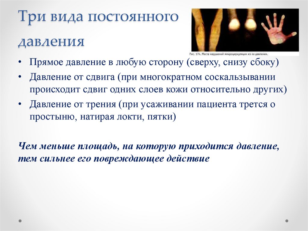 Три вида постоянного давления