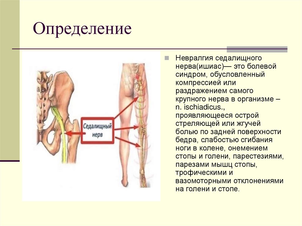 Определение