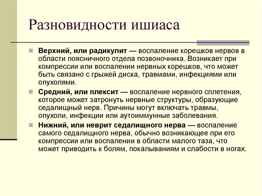 Разновидности ишиаса