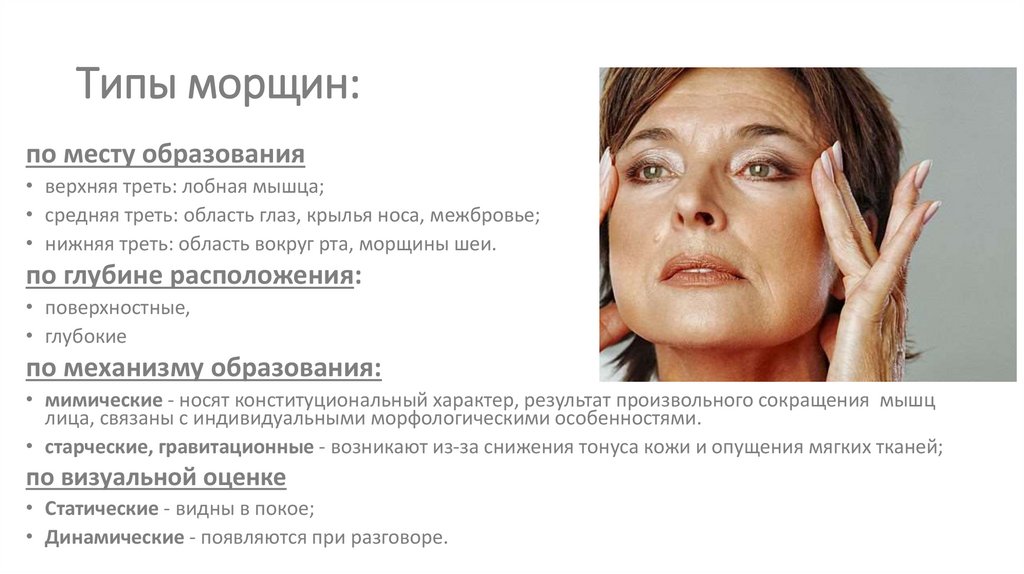 Типы морщин: