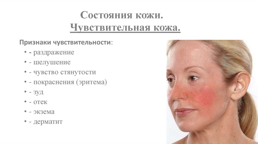 Состояния кожи. Чувствительная кожа.