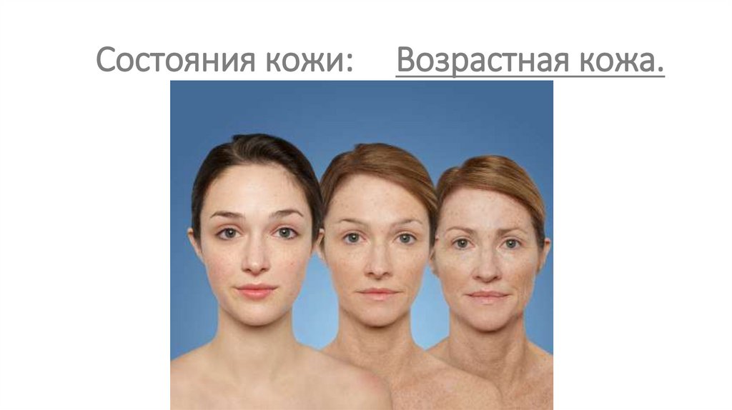 Состояния кожи: Возрастная кожа.