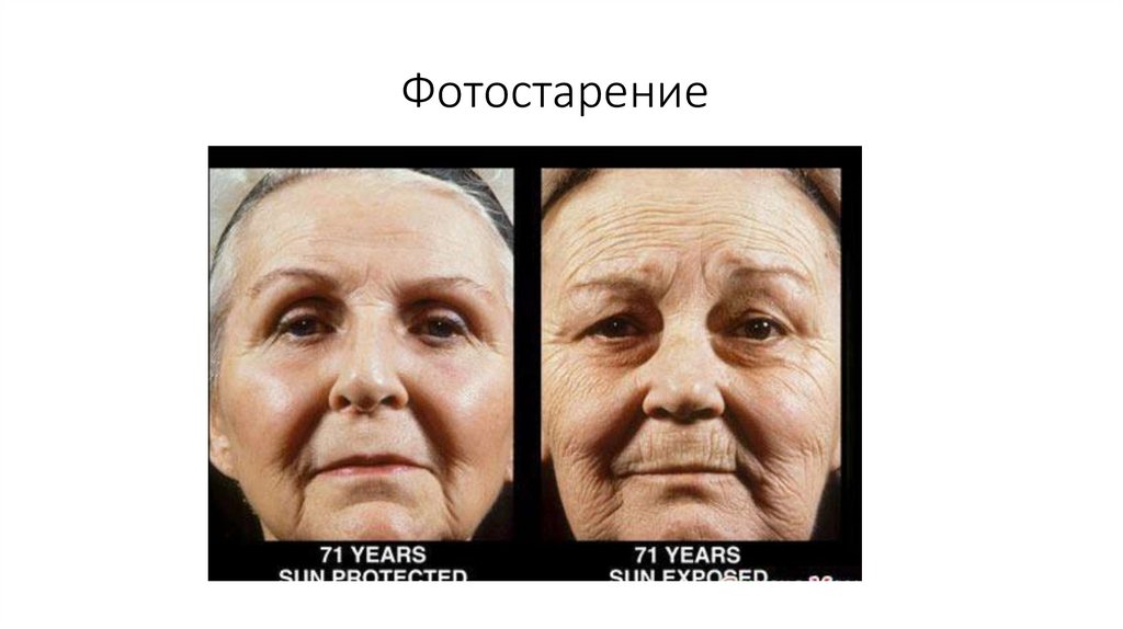 Фотостарение