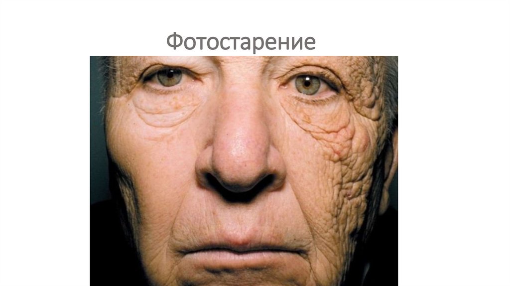 Фотостарение