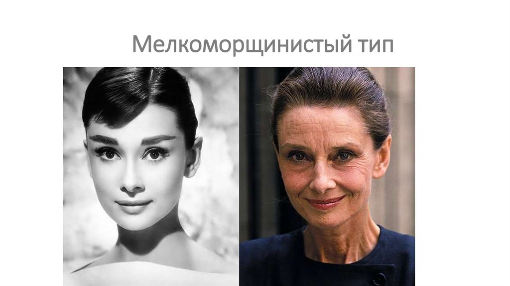 Мелкоморщинистый тип