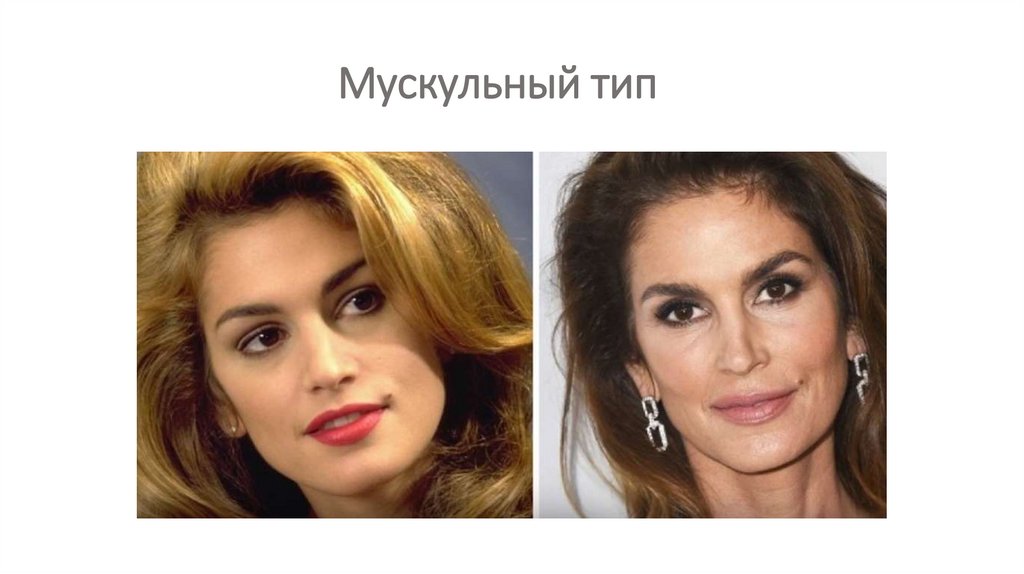 Мускульный тип