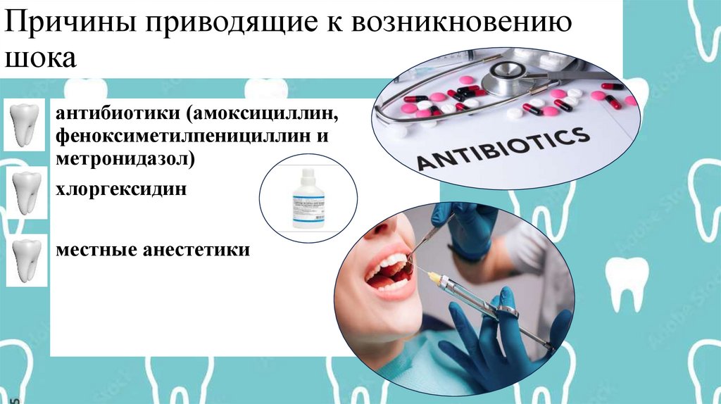 Причины приводящие к возникновению шока