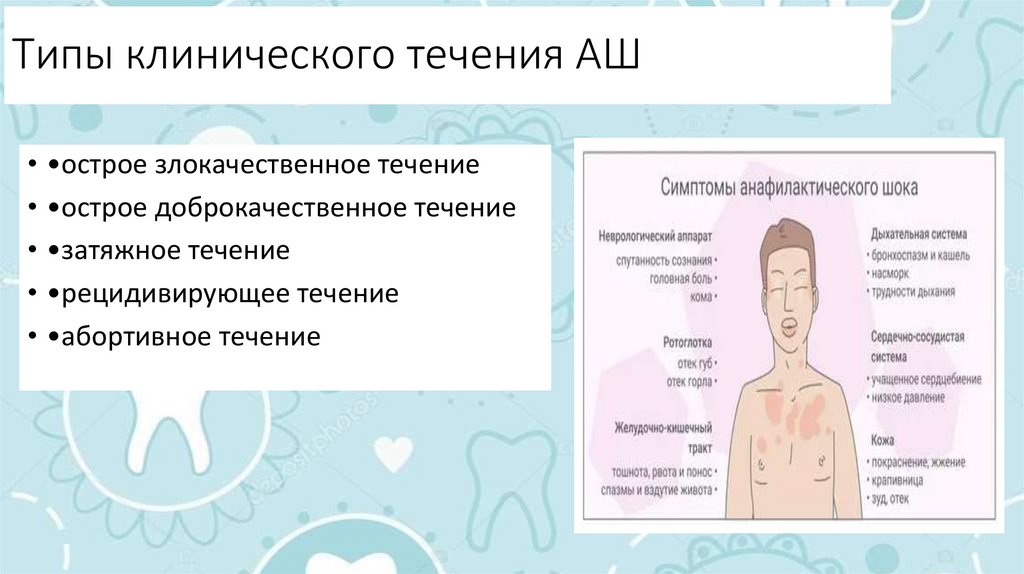 Типы клинического течения АШ