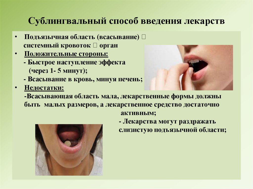 Сублингвальный способ введения лекарств