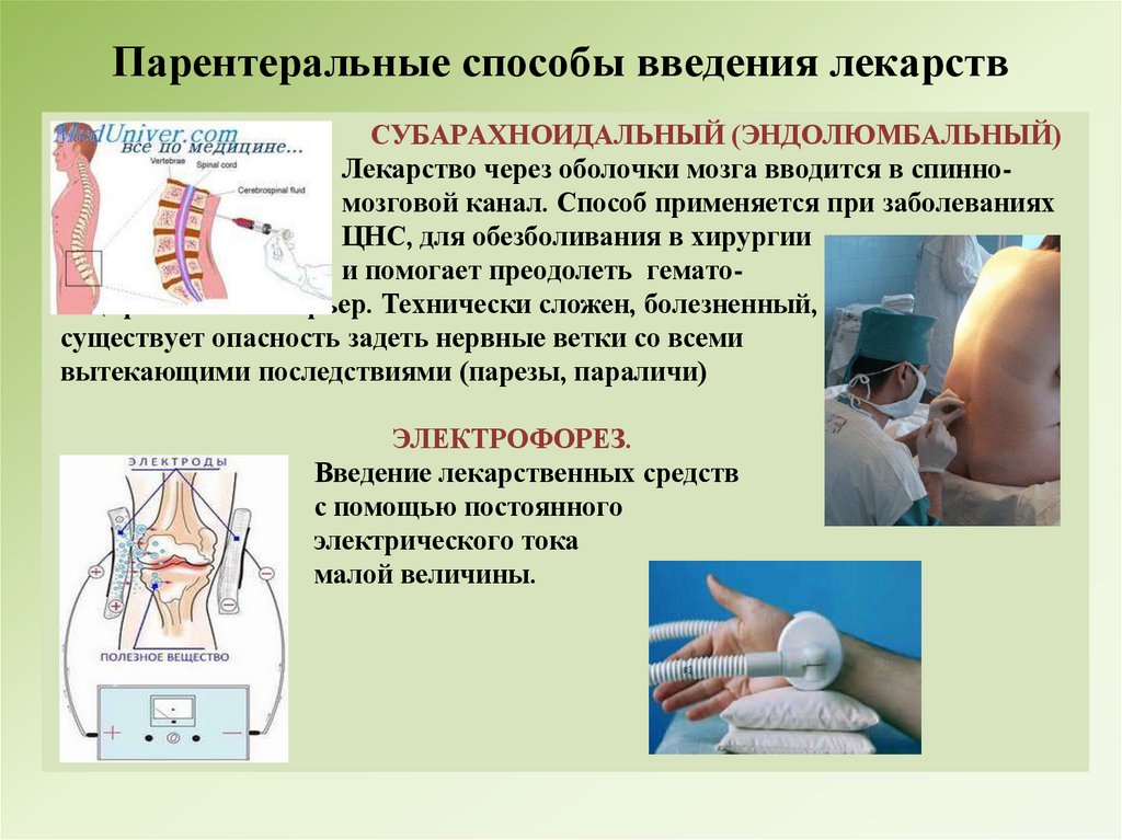 Парентеральные способы введения лекарств