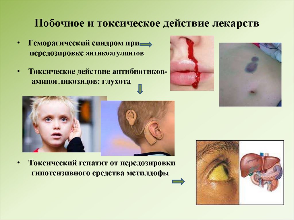 Побочное и токсическое действие лекарств