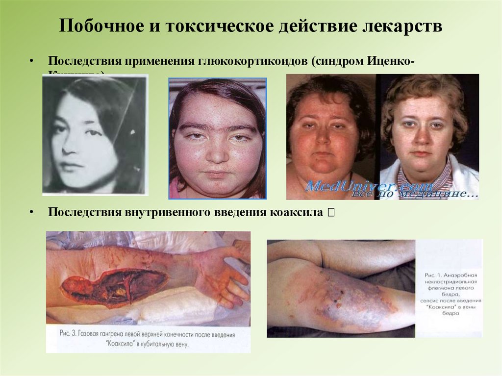 Побочное и токсическое действие лекарств