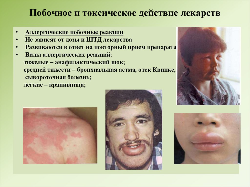 Побочное и токсическое действие лекарств