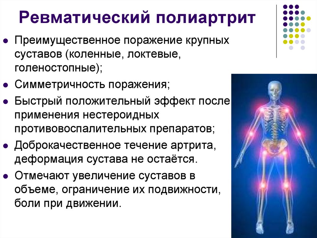 Ревматический полиартрит