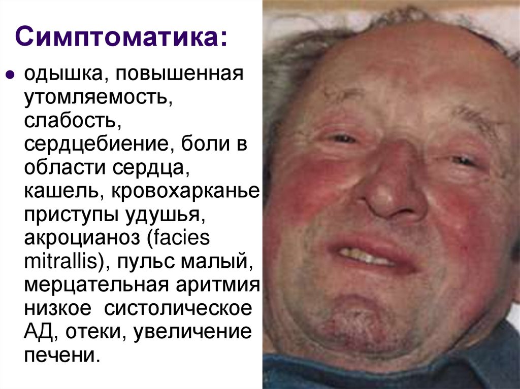 Симптоматика: