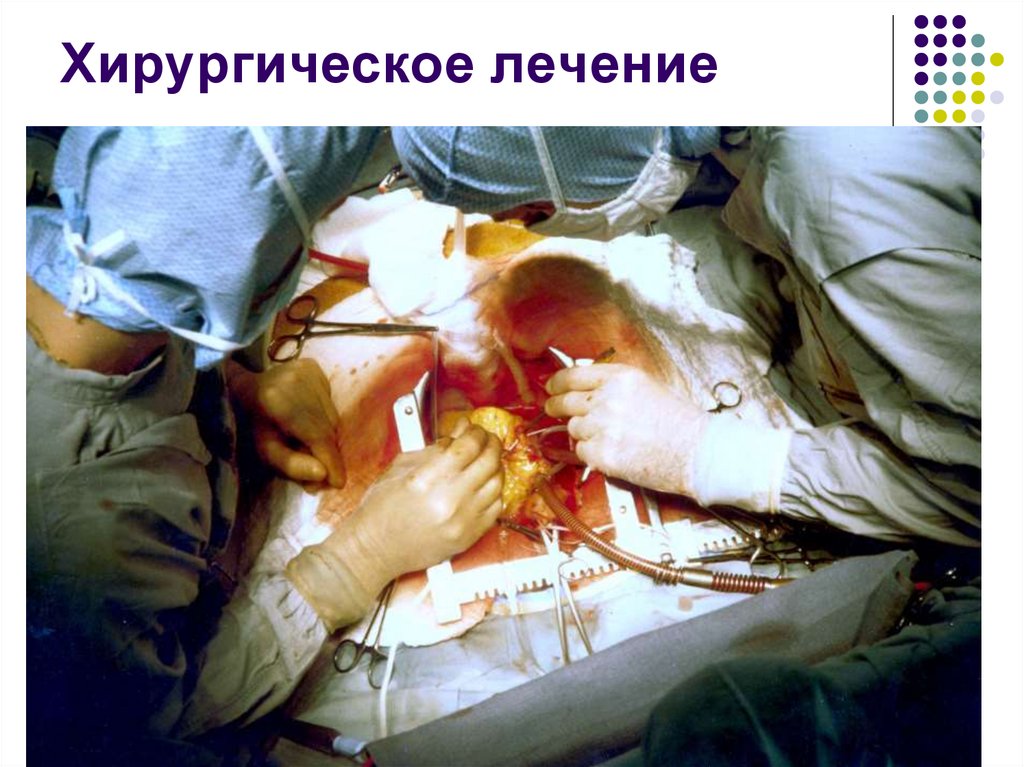 Хирургическое лечение