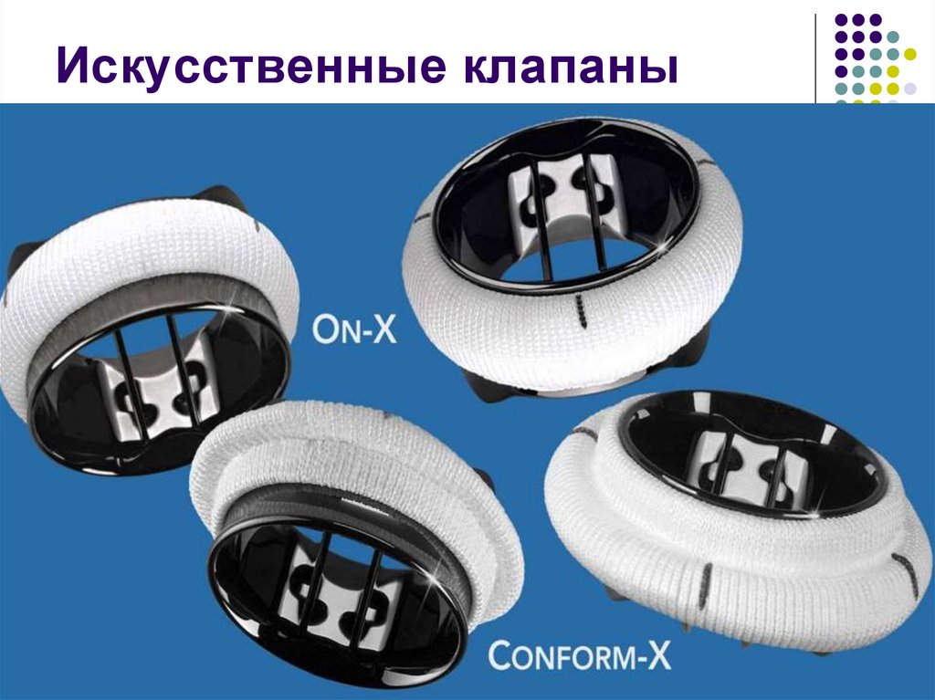 Искусственные клапаны