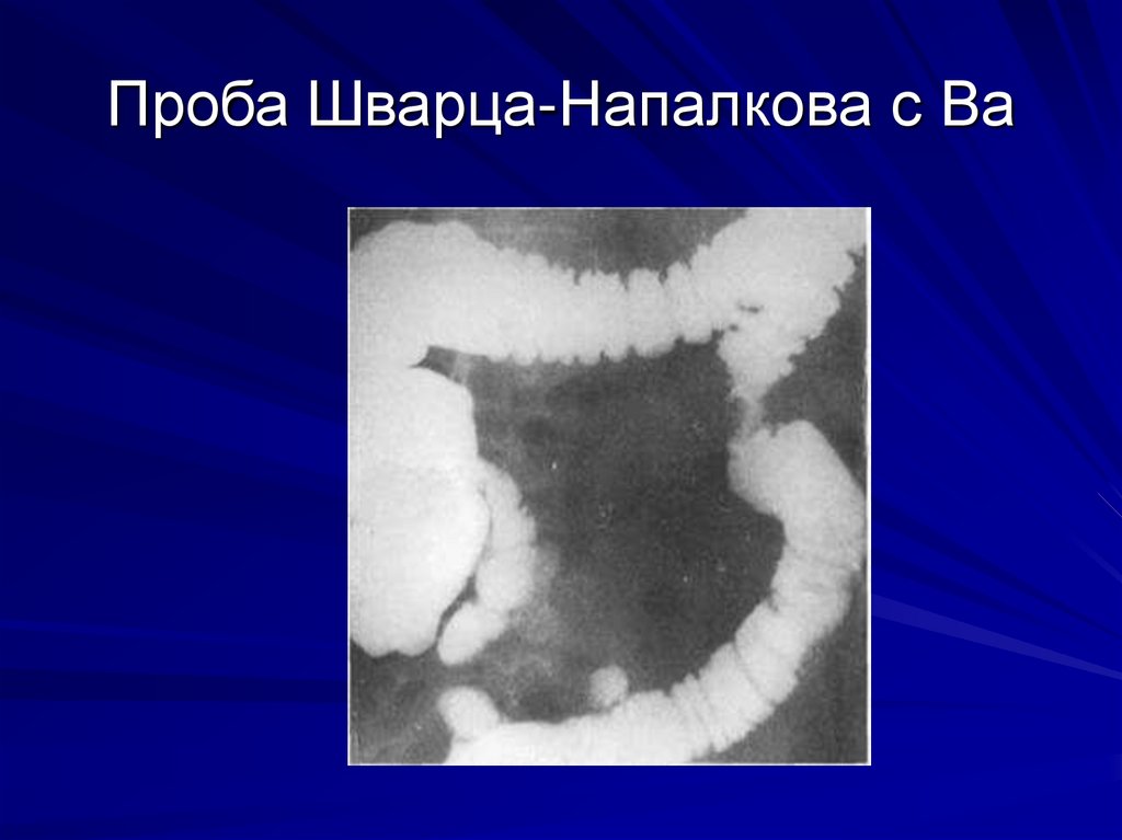 Проба Шварца-Напалкова с Ва