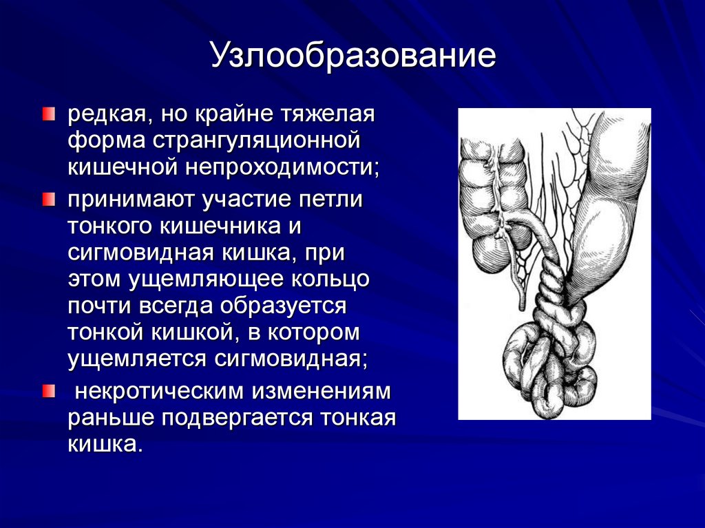 Узлообразование