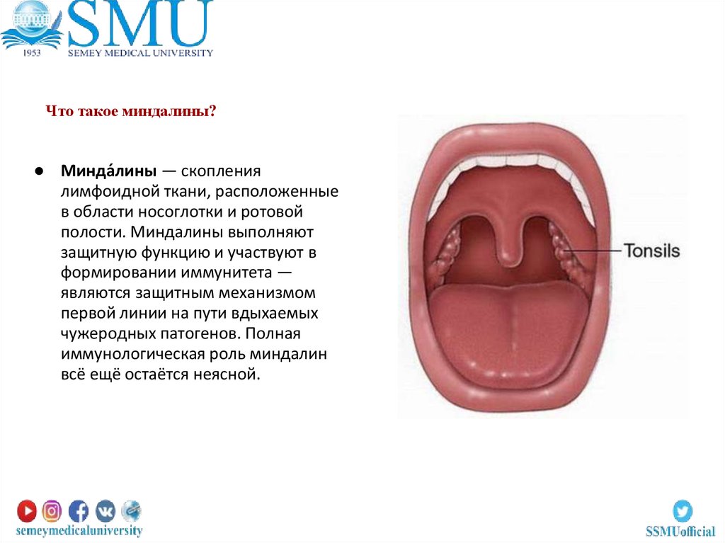 Что такое миндалины?