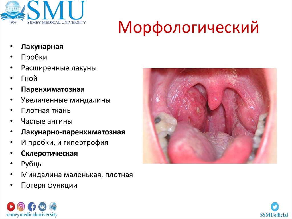 Морфологический