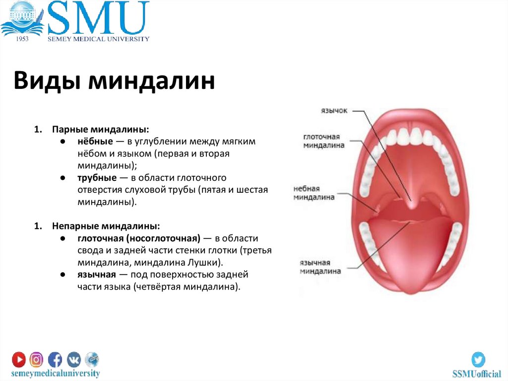 Виды миндалин