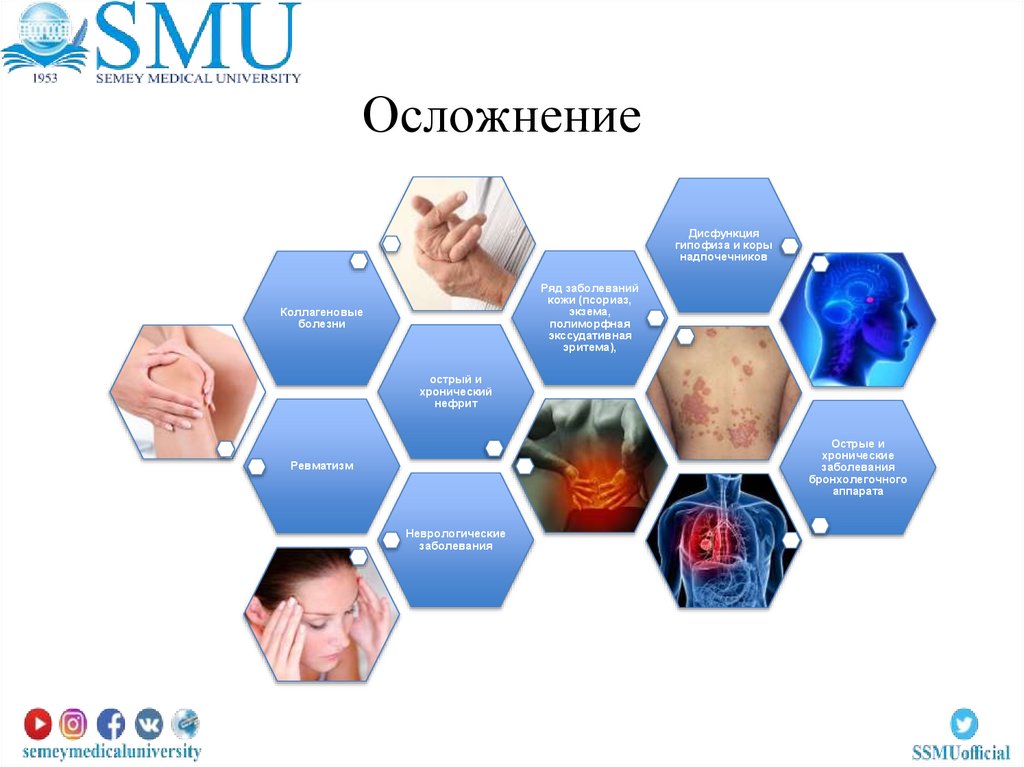 Осложнение