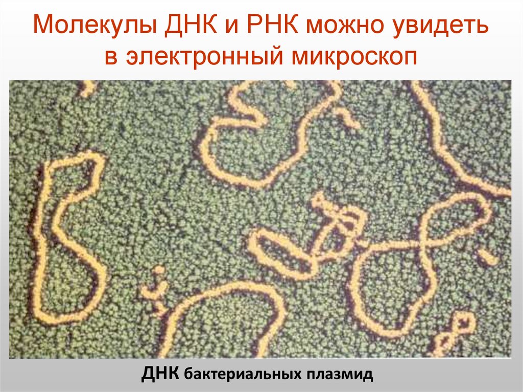 Молекулы ДНК и РНК можно увидеть в электронный микроскоп