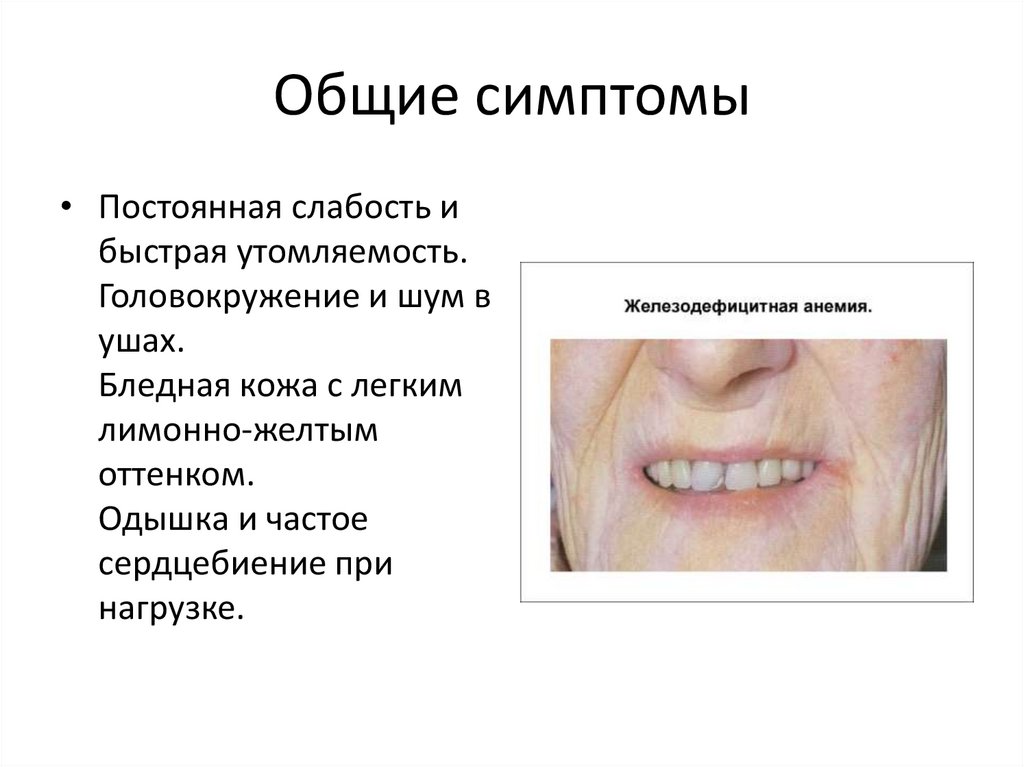 Общие симптомы