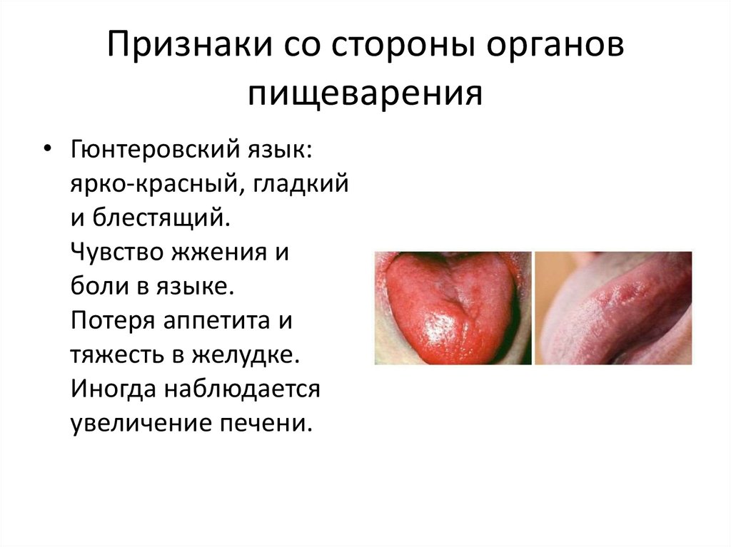 Признаки со стороны органов пищеварения