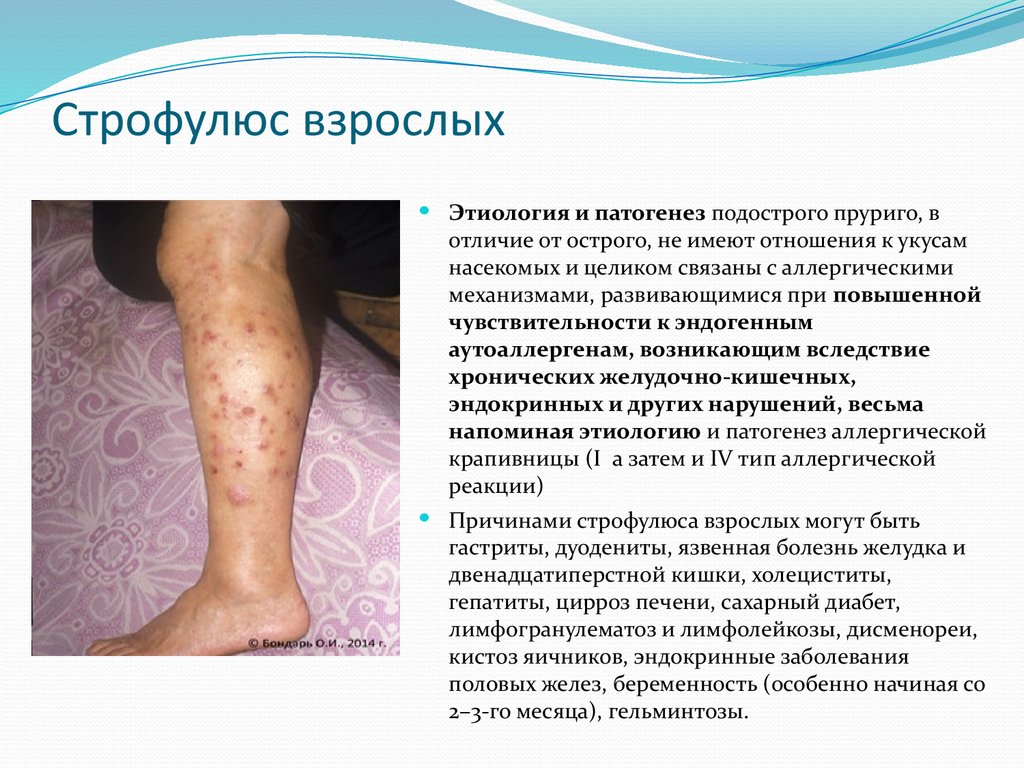 Строфулюс взрослых