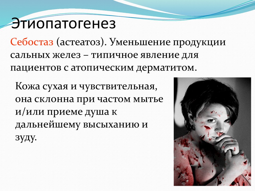 Этиопатогенез